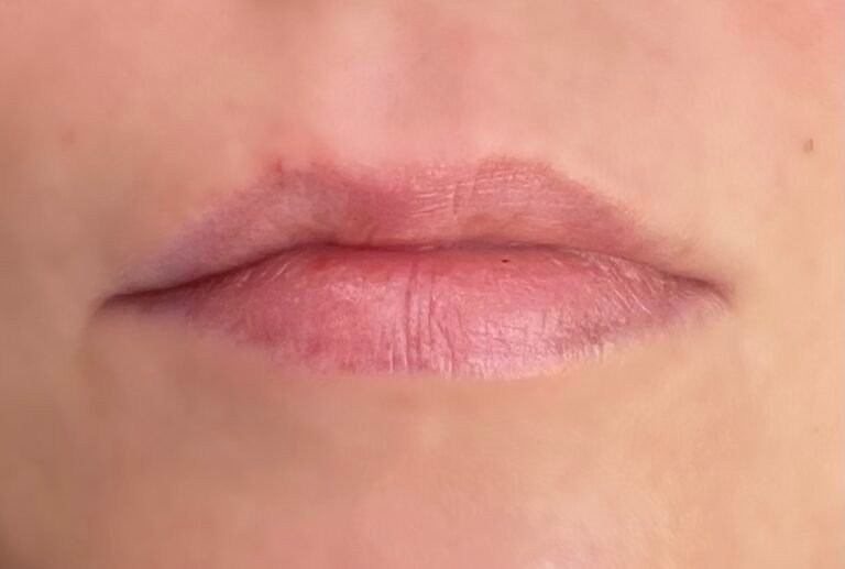 AA6150E4-0F31-42BA-9993-E001E5723C45